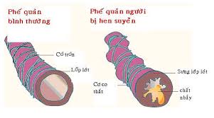 hensuyen