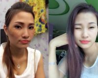 Học cách chăm da nám hiệu quả từ chuyên gia Nhật