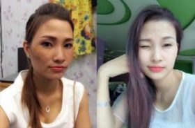Học cách chăm da nám hiệu quả từ chuyên gia Nhật
