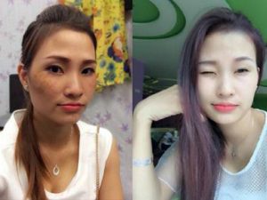 Học cách chăm da nám hiệu quả từ chuyên gia Nhật